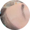 희헤어라인 이미지