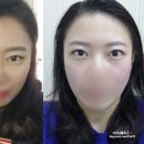 퀸스테틱