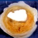 경화 티스토리