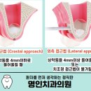 서울명인치과의원 이미지