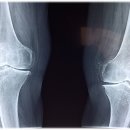 보건복지부 지정 전국 관절전문병원(정형외과) 리스트 총 정리 - 24년 최신