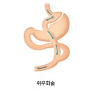 비만의 치료 - 3 이미지