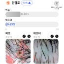 밀스칼프 이미지