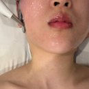 동수원로 | 5회 내돈내산 윤곽관리, 수원신부관리 오늘,동안 곡반정동점 후기