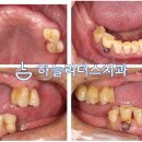 하늘치과기공소 이미지