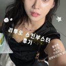양재역 피부과 루비의원 피부관리 리투오 스킨부스터 내돈내산 솔직_경과 후기