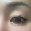 창원글로리안과의원 이미지