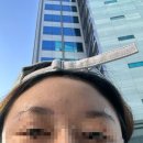 전주바른약국 | 시그니처 성형외과 이마필러 내돈내산 / 4일차까지후기 / 솔직 찐후기