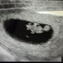 박지원산부인과의원 | 연앤네이쳐산부인과와 호움조산원 상담 후기