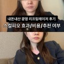 이깔도 | 광명소하동피부과 리프팅레이저 안아픈리프팅 후기 I 친구따라 광명간다 ?! ✨스컬피오 효과/비용/추천 여부