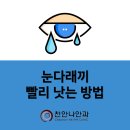 천안나안과의원 이미지