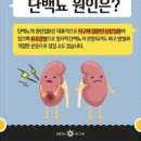 단백뇨 원인 증상 치료 및 관리 방법 이미지