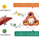 건강검진에서 한번 올라가면 운동,식단으로도 조절 힘들다는 것 이미지