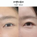 언더라인 | 강남 아이라인 언더라인 리앤시뷰티 재방문 통증 유지력 후기 :)