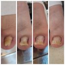 새소망정형외과빌딩 | 광주 내성발톱 전문 케어 금호동 '페티네일 ' 방문 찐 후기