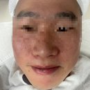 원주 단계동 모공케어 피부관리 “여우야 뷰티샵” 후기