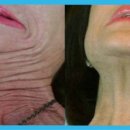 리우메이의원 이미지