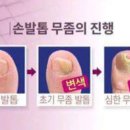 장고 인터네셔널 이미지