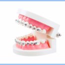 스마일클리어교정치과기공소 | 경안동치과 교정 큰 마케팅 없이 후기가 좋은 까닭