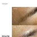 소피레 | [공지] 용산 유일 잔흔제거 전문샵 소피레 찐 후기!!!!