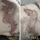 동의김해한의원 | 대상포진한의원, 진료과마다 주는 진통제가 통하지 않는 이유 1가지.