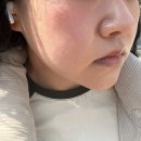 봉오대로3R | [인천 피부관리] 센스미 스킨케어ㅣ아로마테라피ㅣ물방울관리ㅣ효성동 피부관리