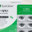 글로아이