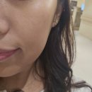 세안한방병원 | 구미 산동 피부과 대신 한방병원 슈링크유니버스 LDM 후기 + 스시 맛집