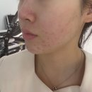 온정약국 | 창원 뷰티샵 킴방울에서 멜라핏 관리 받고 왔어요! 잡티·모공에 광채까지 완벽