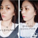 뷰티라인 이미지