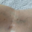 정기원 | 힘없이 뒤뚱거리는 걸음 내포 통증집중마사지 정기원 방문 후기