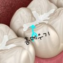 율하예미송키즈치과 네이버블로그
