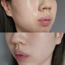 인천터미널역 | 인천터미널역피부과 구월동쥬베룩후기
