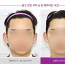 모앤