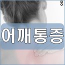 부암3동-9 | 파주어깨통증한의원 지긋지긋한 통증에서 벗어나요