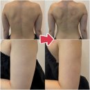 CU 서산이안큐브점 | 서산에어바디 웨딩케어 1회만 받아도 이정도? 예비신부 상체관리 찐후기 / 루아뷰티