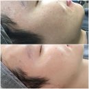 피부환상 이미지