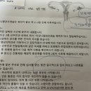 시엘병원 | 시엘병원 나팔관조영술 촬영 후기, 금액