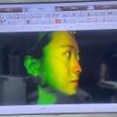 써마지 FLX 600샷 한달 후기 (통증 가격 효과)