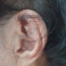 베스트 보청기 | 천안아산365베스트보청기 포낙보청기 인피니오 I90 착용 후기 — 고객이 직접 말한 변화