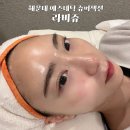 해운대 피부관리 라비쥬에서 슈퍼젝션 받고 꿀 피부 된 후기