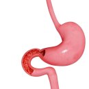 필라테스 귤 이미지