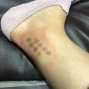 엘리나의원 | 일상후기‣ 6년만에 올리는 창원 타투제거 후기