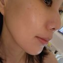 미 사랑피부관리 | 향남피부과 속건조 스킨부스터 미쥬란 피부관리 후기