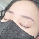 닥터브로우 이미지