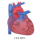 ﻿협심증의 진단과 치료 이미지