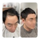 킹스헤어 | 서면 맨즈헤어 킹스그룸바버샵 에서 부산탈모컷 진행후기