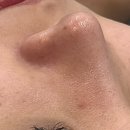 봄에스테틱 이미지