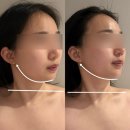 대전광역시청 | 둔산동 에스테틱 신부관리 끌리메 대전시청점 솔직후기