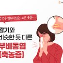 노란콧물 원인과 대처 이미지